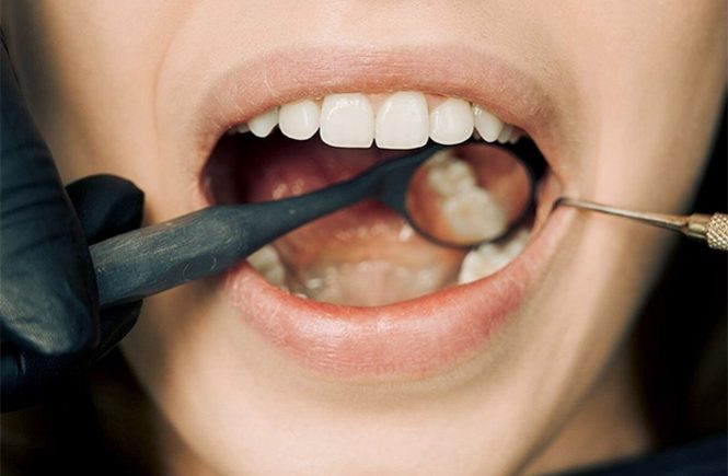 The Comprehensive Guide to the Importance of Gum Health in Oral Care