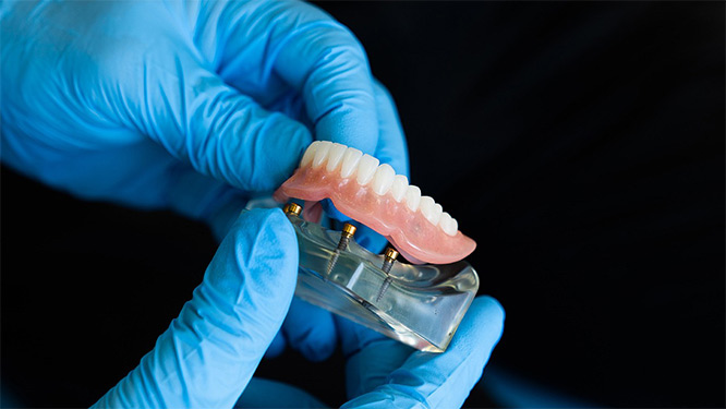 Planning To Get Dentures? 7 Surprising Benefits You Need To Know