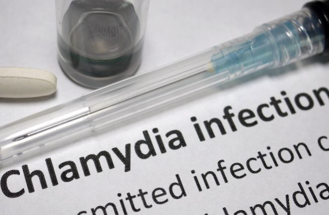 The Signs and Symptoms of Chlamydia: What To Do