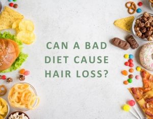 Can a Bad Diet Cause Hair Loss?